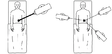 \begin{figure}\centerline{\psfig{file=tumor-sequence.ps,height=2in}}\end{figure}